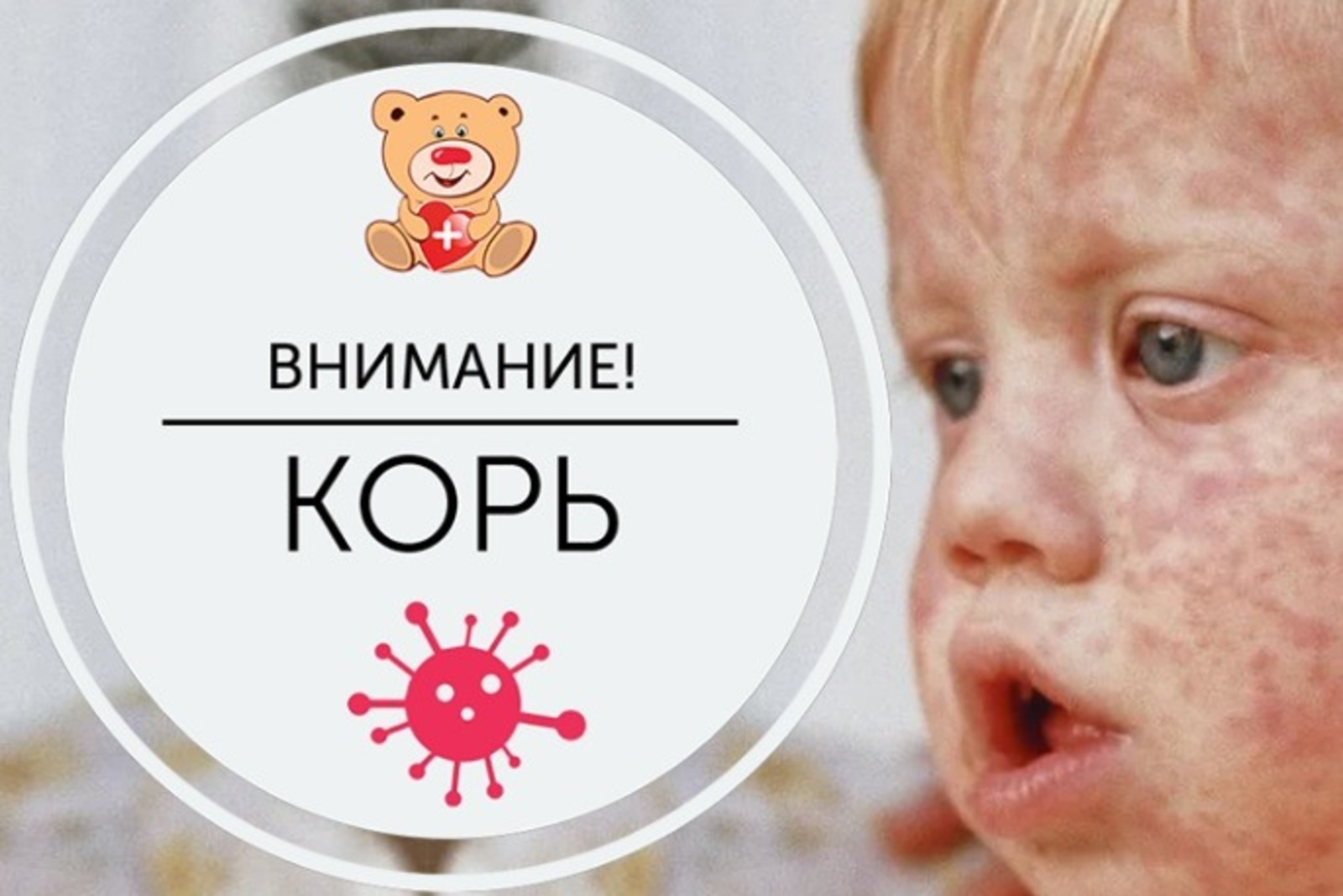 Санитарно-противоэпидемическая комиссия  Усть-Джегутинского муниципального района информирует.